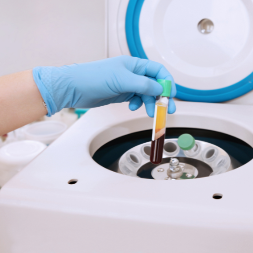 platelet rich plasma