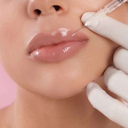 dermal fillers